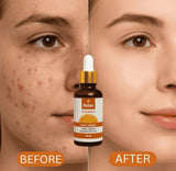 Relax Vitamin C Daily Serum - 30ml | Brightening & Anti-Aging Facial Serum
